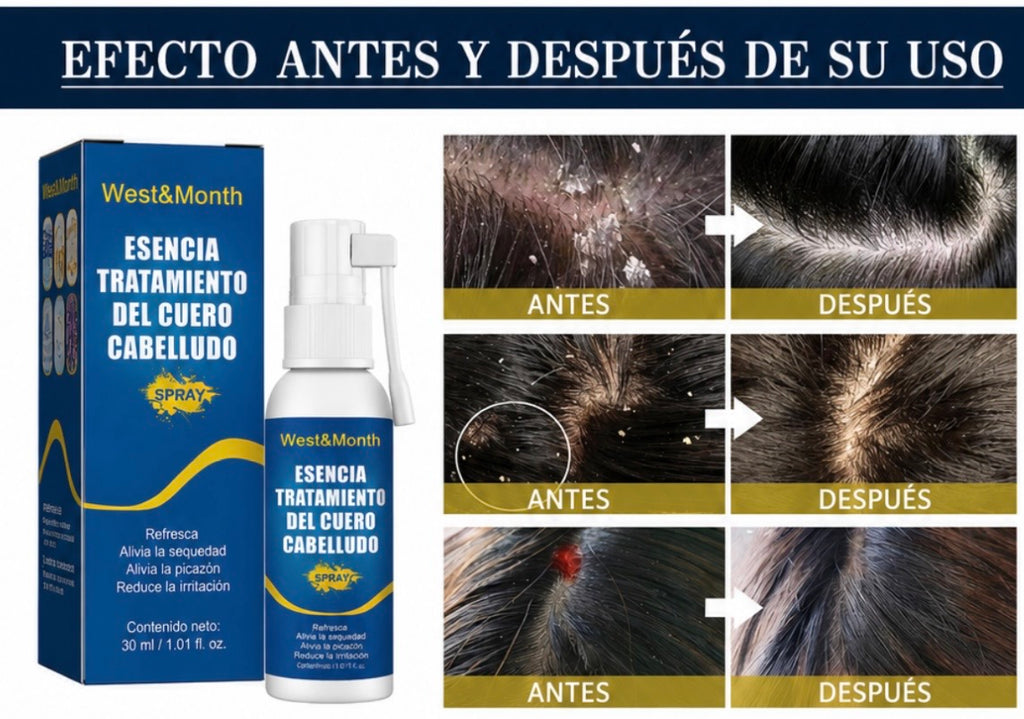 Spray reparador de folículos pilosos y fortalecimiento de las raíces